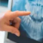 La imagen 3 de la Empresa ARPEL DENTAL SL Salud y Medicina en Madrid M