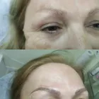 La imagen 27 de la Empresa CENTRO DE ESTÉTICA YUNAI Salud y Medicina en Fuenlabrada M