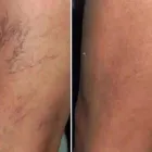 La imagen 29 de la Empresa CENTRO DE ESTÉTICA YUNAI Salud y Medicina en Fuenlabrada M