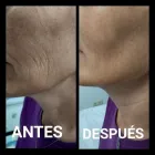 La imagen 32 de la Empresa CENTRO DE ESTÉTICA YUNAI Salud y Medicina en Fuenlabrada M