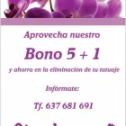 La imagen 1 de la Empresa CIAO TATTOO Eliminacion De Tatuaje en Sevilla SE