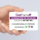 La imagen 3 de la Empresa CIAO TATTOO Eliminacion De Tatuaje en Sevilla SE