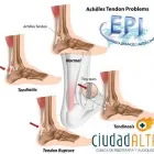 La imagen 10 de la Empresa CIUDAD ALTA CLINICA DE FISIOTERAPIA Y AUDIOLOGÍA Salud y Medicina en Las Palmas de Gran Canaria GC