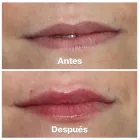 La imagen 5 de la Empresa CLÍNICA DENTAL AD AD Salud y Medicina en Las Palmas de Gran Canaria GC