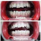 La imagen 6 de la Empresa CLÍNICA DENTAL AD AD Salud y Medicina en Las Palmas de Gran Canaria GC