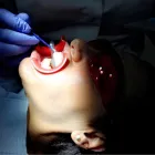 La imagen 13 de la Empresa CLÍNICA DENTAL AD AD Salud y Medicina en Las Palmas de Gran Canaria GC