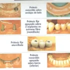 La imagen 1 de la Empresa CLINICA DENTAL CLI-DEN Salud y Medicina en Madrid M