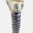 La imagen 5 de la Empresa CLINICA DENTAL MERINO CUESTA Salud y Medicina en Gijón O