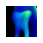 La imagen 7 de la Empresa CLINICA DENTAL MERINO CUESTA Salud y Medicina en Gijón O