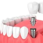 La imagen 4 de la Empresa CLINICA DENTAL PACIOS VELEDA Salud y Medicina en Madrid M