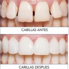 La imagen 7 de la Empresa CLÍNICA DENTAL PALOMERAS Salud y Medicina en Madrid M