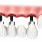 La imagen 1 de la Empresa CLÍNICA DENTAL SHARK Salud y Medicina en Adeje TF