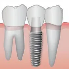 La imagen 13 de la Empresa CLÍNICA DENTAL SHARK Salud y Medicina en Adeje TF