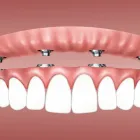 La imagen 16 de la Empresa CLÍNICA DENTAL SHARK Salud y Medicina en Adeje TF