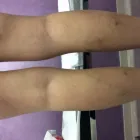 La imagen 1 de la Empresa CLÍNICA VASCULAR DR. AURELI MUÑOZ S.L. Servicios Legales y Financieros en Terrassa B