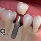 La imagen 4 de la Empresa COSTA ADEJE DENTAL CENTER Salud y Medicina en Costa Adeje TF