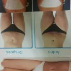 La imagen 2 de la Empresa ESTÉTICA INA CASTRO Salud y Medicina en Madrid M