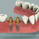 La imagen 1 de la Empresa FIRST DENTAL Salud y Medicina en Majadahonda M