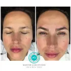 La imagen 6 de la Empresa MASTER LASH STUDIO Salones de Belleza en Barcelona B