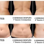 La imagen 2 de la Empresa NEW HEAVEN ESTÉTICA Salud y Medicina en Mejorada del Campo M