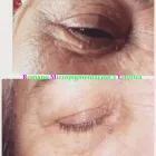 La imagen 5 de la Empresa ROMANO MICROPIGMENTACIÓN ESTÉTICA ONCOLÓGICA PARAMÉDICA Y MICROBLADING Salud y Medicina en Madrid M
