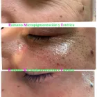 La imagen 6 de la Empresa ROMANO MICROPIGMENTACIÓN ESTÉTICA ONCOLÓGICA PARAMÉDICA Y MICROBLADING Salud y Medicina en Madrid M