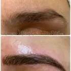 La imagen 7 de la Empresa ROMANO MICROPIGMENTACIÓN ESTÉTICA ONCOLÓGICA PARAMÉDICA Y MICROBLADING Salud y Medicina en Madrid M