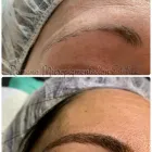 La imagen 8 de la Empresa ROMANO MICROPIGMENTACIÓN ESTÉTICA ONCOLÓGICA PARAMÉDICA Y MICROBLADING Salud y Medicina en Madrid M