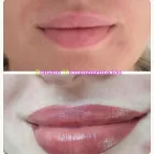 La imagen 15 de la Empresa ROMANO MICROPIGMENTACIÓN ESTÉTICA ONCOLÓGICA PARAMÉDICA Y MICROBLADING Salud y Medicina en Madrid M