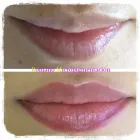 La imagen 16 de la Empresa ROMANO MICROPIGMENTACIÓN ESTÉTICA ONCOLÓGICA PARAMÉDICA Y MICROBLADING Salud y Medicina en Madrid M