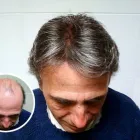 La imagen 3 de la Empresa S&M CENTROS CAPILARES PELUCAS - PRÓTESIS CAPILARES Tienda de Suministros para Peluquería en Algeciras CA