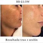 La imagen 3 de la Empresa SALÓN DE BELLEZA LOTUS Productos y Servicios de Cuidado Personal en Barcelona B