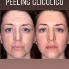 La imagen 12 de la Empresa SALÓN DE BELLEZA LOTUS Productos y Servicios de Cuidado Personal en Barcelona B