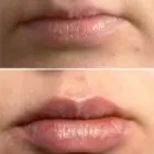 La imagen 20 de la Empresa SALÓN DE BELLEZA LOTUS Productos y Servicios de Cuidado Personal en Barcelona B