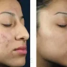 La imagen 24 de la Empresa SALÓN DE BELLEZA LOTUS Productos y Servicios de Cuidado Personal en Barcelona B