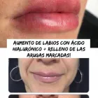 La imagen 30 de la Empresa SALÓN DE BELLEZA LOTUS Productos y Servicios de Cuidado Personal en Barcelona B