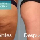 La imagen 10 de la Empresa SALÓN LOUNGE ESTILISTES Salud y Medicina en Barcelona B