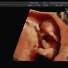 La imagen 5 de la Empresa SAMARANCH CONSULTA Medicos Especialistas: Ginecologia Y Obstetricia en Barcelona B