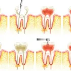 La imagen 2 de la Empresa SOLUCION DENTAL IDENTALITAS Salud y Medicina en Valdemoro M