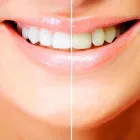 La imagen 6 de la Empresa SOLUCION DENTAL IDENTALITAS Salud y Medicina en Valdemoro M