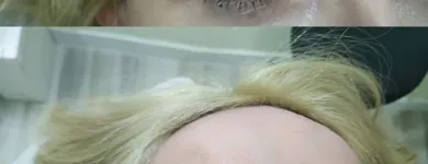 La imagen 18 de la Empresa CENTRO DE ESTÉTICA YUNAI Salud y Medicina en Fuenlabrada M
