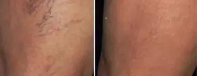 La imagen 29 de la Empresa CENTRO DE ESTÉTICA YUNAI Salud y Medicina en Fuenlabrada M