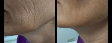La imagen 32 de la Empresa CENTRO DE ESTÉTICA YUNAI Salud y Medicina en Fuenlabrada M