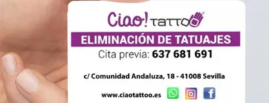 La imagen 3 de la Empresa CIAO TATTOO Eliminacion De Tatuaje en Sevilla SE