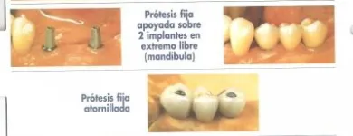 La imagen 1 de la Empresa CLINICA DENTAL CLI-DEN Salud y Medicina en Madrid M