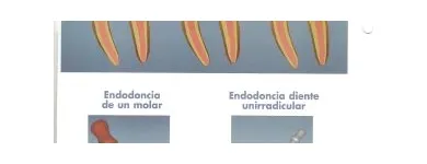 La imagen 4 de la Empresa CLINICA DENTAL CLI-DEN Salud y Medicina en Madrid M