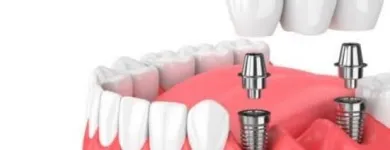 La imagen 4 de la Empresa CLINICA DENTAL PACIOS VELEDA Salud y Medicina en Madrid M