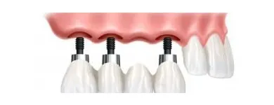 La imagen 1 de la Empresa CLÍNICA DENTAL SHARK Salud y Medicina en Adeje TF