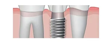 La imagen 13 de la Empresa CLÍNICA DENTAL SHARK Salud y Medicina en Adeje TF