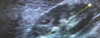 La imagen 1 de la Empresa DOCTOR GONZALO CABRERA ROCA Salud y Medicina en Las Palmas de Gran Canaria GC